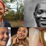 Golden Teeth