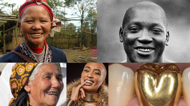 Golden Teeth