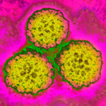 One in Eight Cancers Are Linked to Infections, New Global Study Reveals